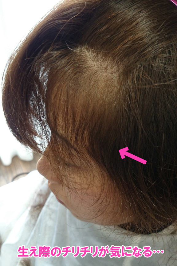 加齢による髪のチリチリ パサパサの原因と対策について