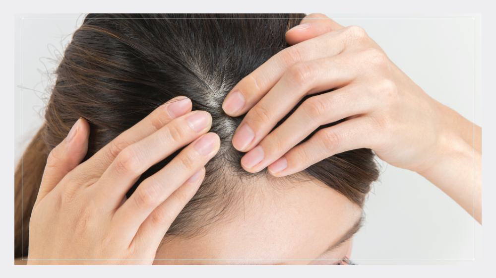 頭皮の乾燥 5つの原因と今日からできる対策を美容師が解説