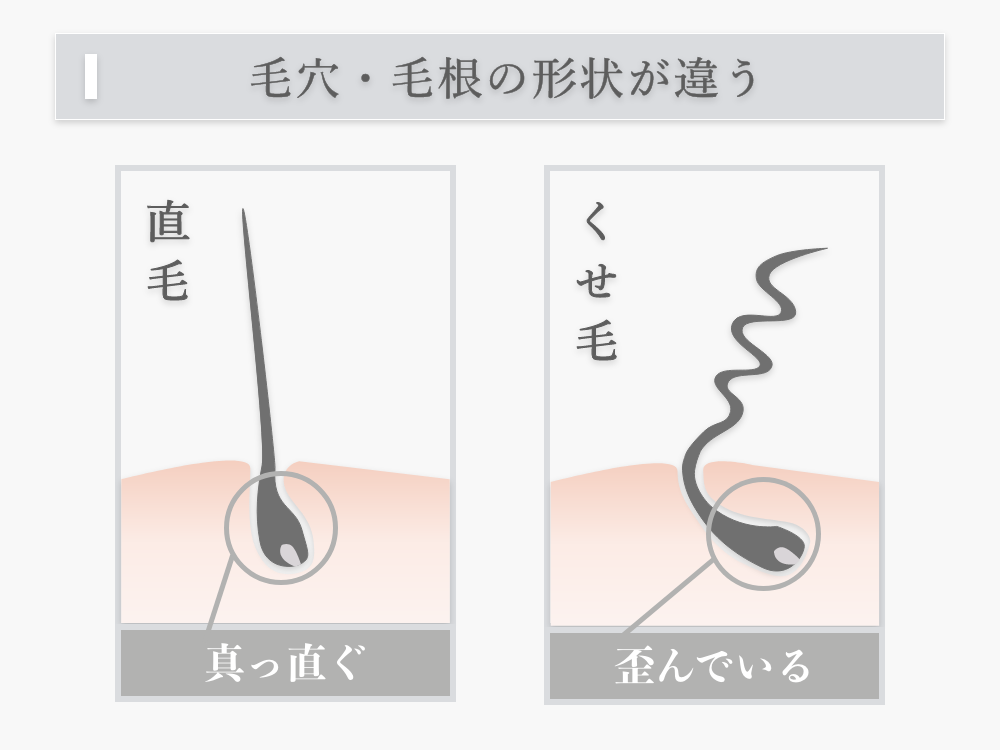 くせ毛診断 タイプ別 おすすめの髪型とくせ毛のヘアケア徹底解説